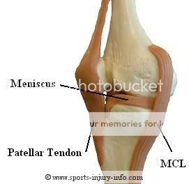 (Stretched pelvic ligaments / tendon disk ligament imaging)